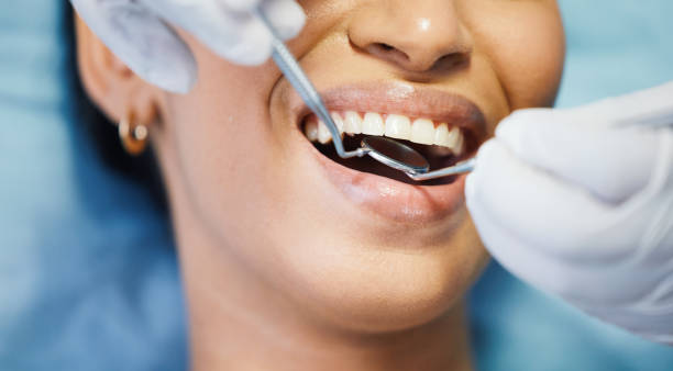 Best Emergency Broken Tooth Repair in Galveston, TX